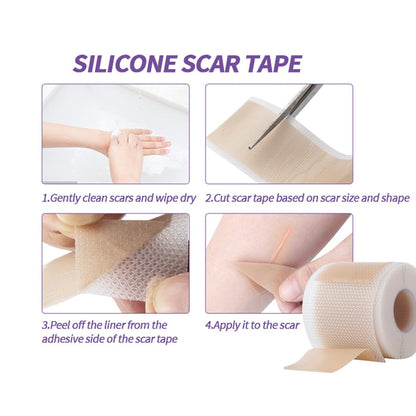 Medical Grade Silicone Scar Sheets, (1.6" x 60" Scar Roll-1.5M) - Reusable Scar Removal Tape Strips for Surgical,C-Section,Tummy Tuck,Keloid Scars Keloid Bump Removal