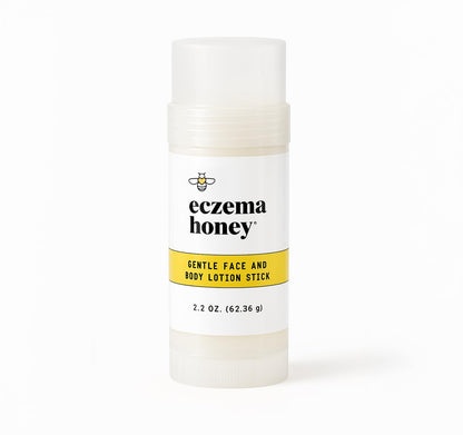 ECZEMA HONEY Gentle Face & Body Lotion Stick for Psoriasis & More (2.2 Oz)