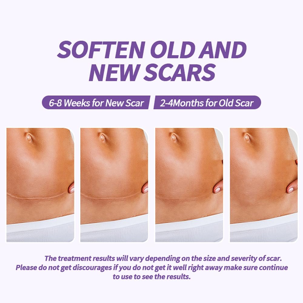Medical Grade Silicone Scar Sheets, (1.6" x 60" Scar Roll-1.5M) - Reusable Scar Removal Tape Strips for Surgical,C-Section,Tummy Tuck,Keloid Scars Keloid Bump Removal