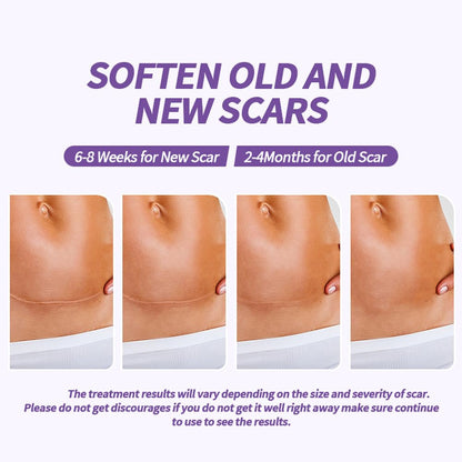 Medical Grade Silicone Scar Sheets, (1.6" x 60" Scar Roll-1.5M) - Reusable Scar Removal Tape Strips for Surgical,C-Section,Tummy Tuck,Keloid Scars Keloid Bump Removal