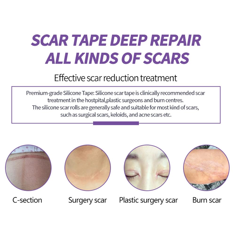 Medical Grade Silicone Scar Sheets, (1.6" x 60" Scar Roll-1.5M) - Reusable Scar Removal Tape Strips for Surgical,C-Section,Tummy Tuck,Keloid Scars Keloid Bump Removal