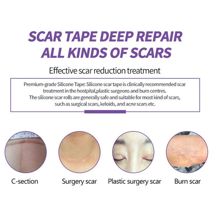 Medical Grade Silicone Scar Sheets, (1.6" x 60" Scar Roll-1.5M) - Reusable Scar Removal Tape Strips for Surgical,C-Section,Tummy Tuck,Keloid Scars Keloid Bump Removal