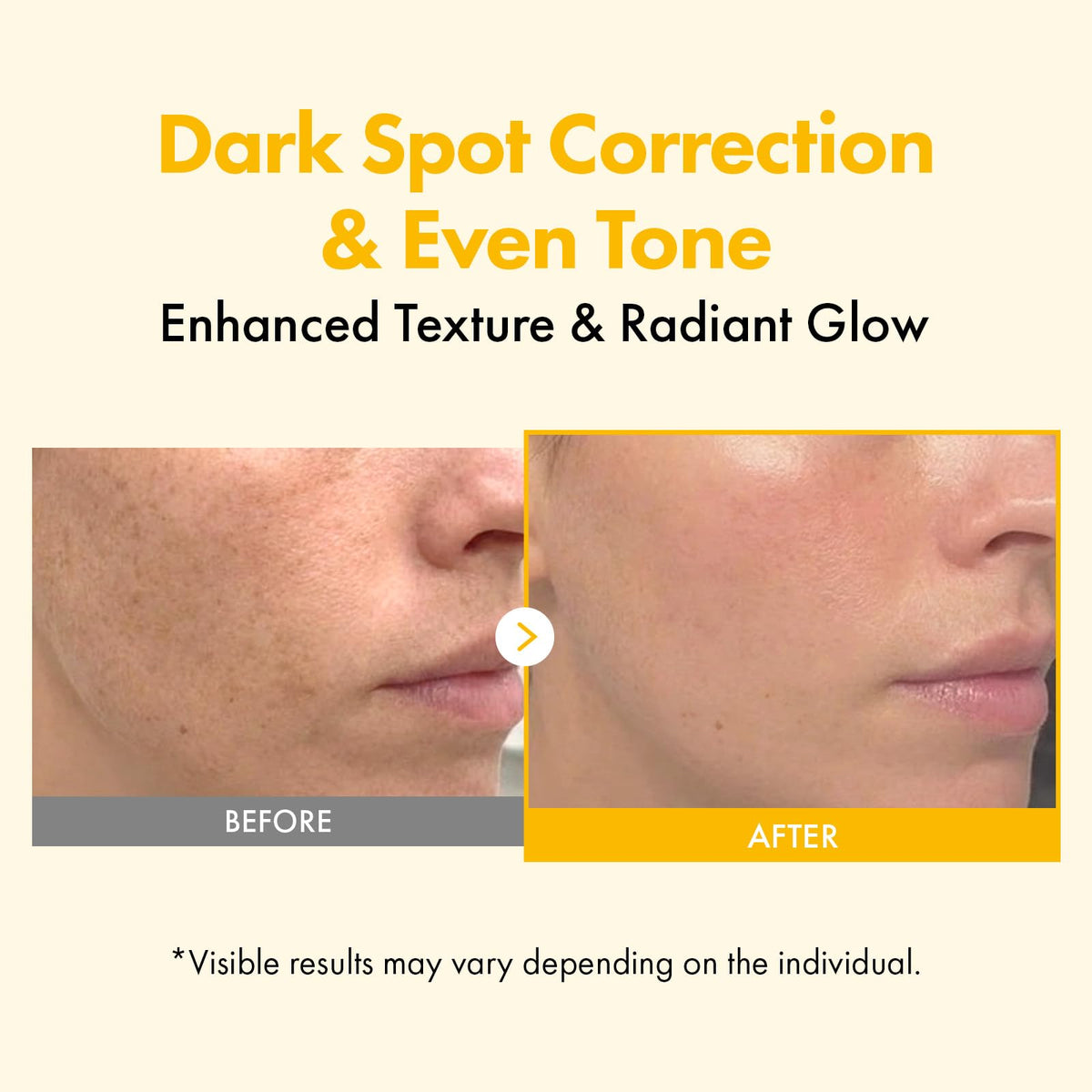 TOSOWOONG Kojic Acid Turmeric Overnight Wrapping Mask for Dark Spots, Glow
