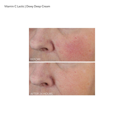 Dr Dennis Gross Vitamin C Lactic Dewy Deep Cream - Ultra-rich - For Dewier & Visibly Firmer, Lifted Skin - All Skin Types - 2 oz