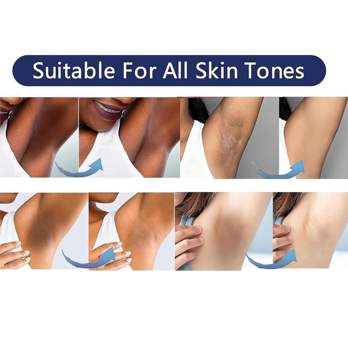 Skin Bleaching Cream for Body Intimate Areas, Private Parts, Underarm, Knees, Elbows, Inner Thigh, Bikini Area, armpit, Skin Lightening Whitening Cream Dark Spot Remover for Intimate Areas 1.7FL OZ
