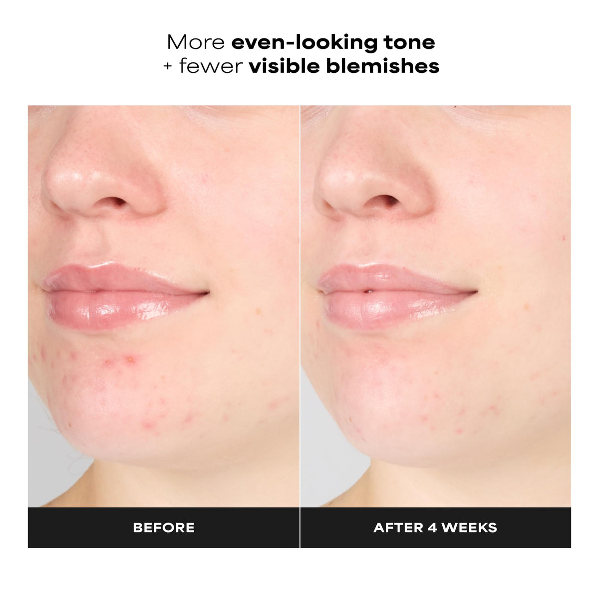 Paula's Choice SKIN PERFECTING 1% BHA Exfoliating Gel Toner, 3.3 Fl Oz