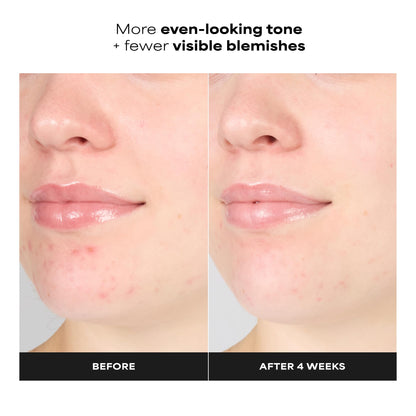 Paula's Choice SKIN PERFECTING 1% BHA Exfoliating Gel Toner, 3.3 Fl Oz