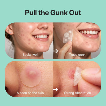 NITEEN 628 Count Pimple Patches for Face, 5 Sizes Hydrocolloid Acne Patches
