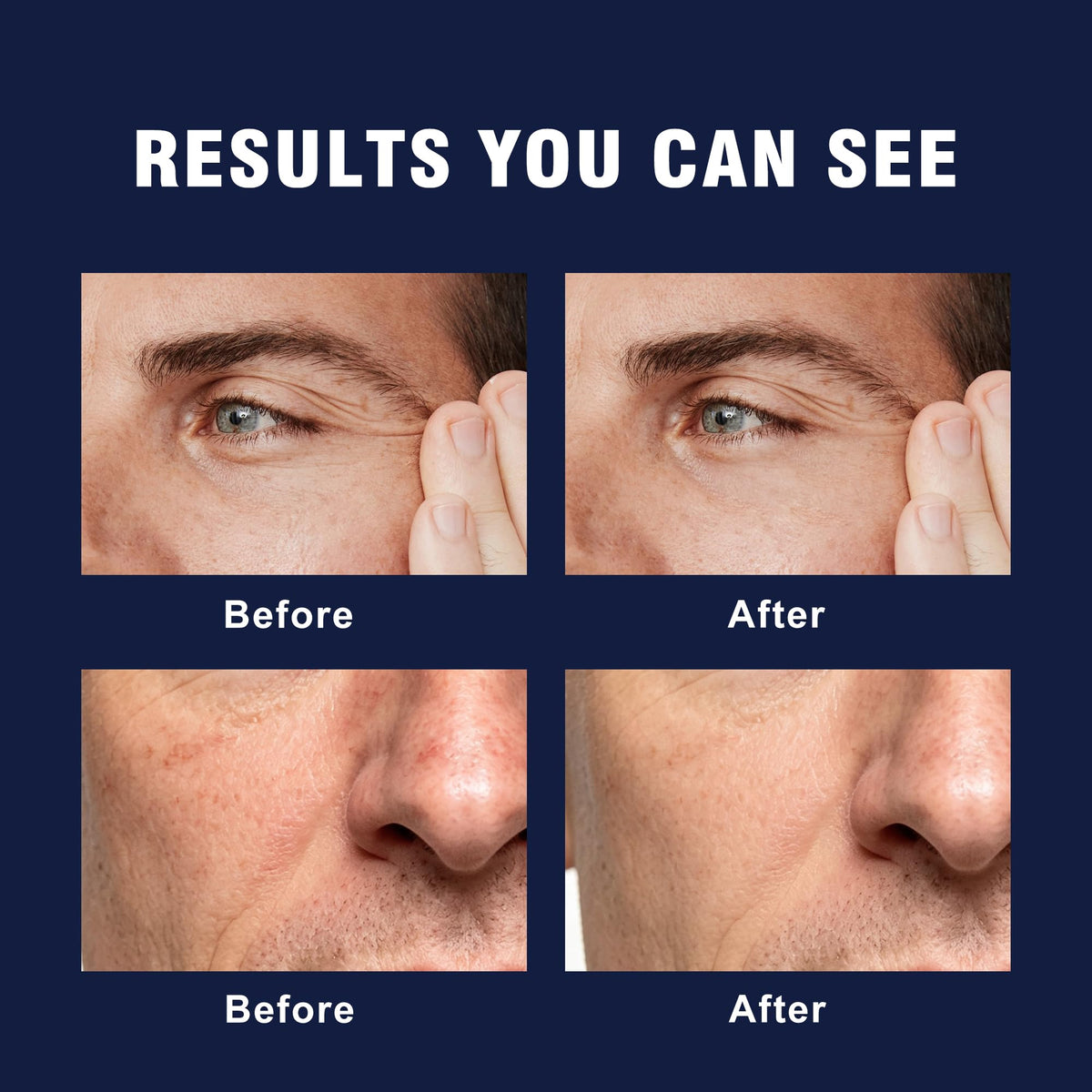 6-in-1 Face Cream for Men – Daily Hydrating Moisturizer for Age Defense