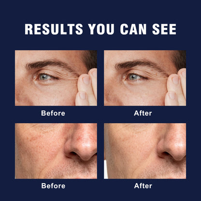 6-in-1 Face Cream for Men – Daily Hydrating Moisturizer for Age Defense