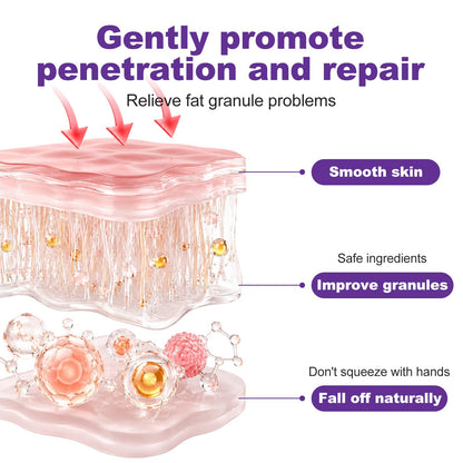 Milia Remover 1% Salicylic Acid for Acne