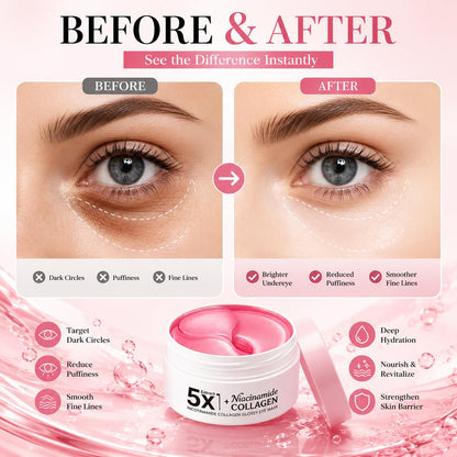 80 PCS Under Eye Patches,Collagen Eye Masks for Puffy Eyes and Dark Circles