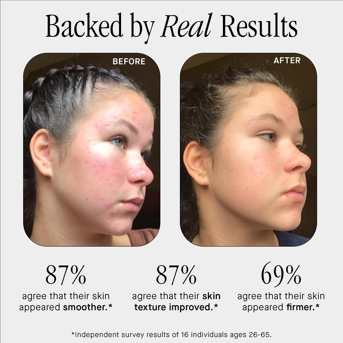 Brandefy No Needles Niacinamide Peptide + Hyaluronic Acid Face Serum