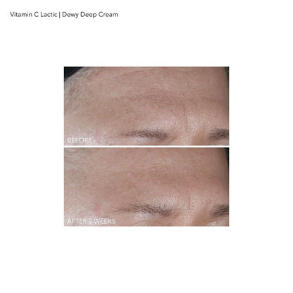 Dr Dennis Gross Vitamin C Lactic Dewy Deep Cream - Ultra-rich - For Dewier & Visibly Firmer, Lifted Skin - All Skin Types - 2 oz