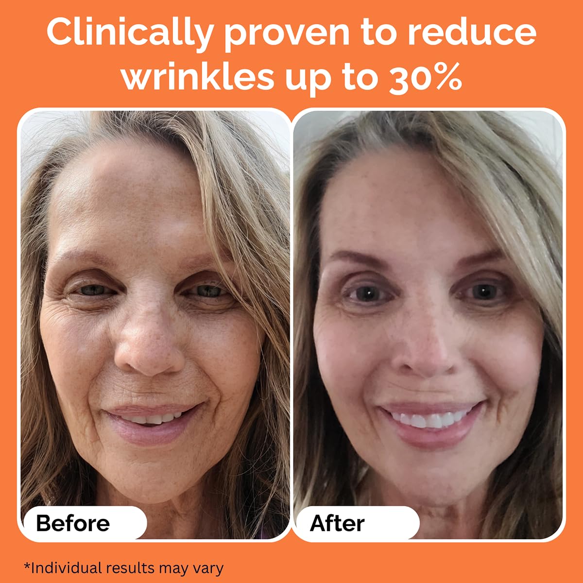 Noche Y Dia Vitamin C Serum for Mature Skin - Water-Free Anti-Aging Face Serum - Hydrates & Smooths - Helps Reduce the Look of Fine Lines & Wrinkles - Made in Spain - 30 mL (1.01 fl oz)