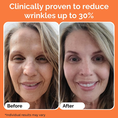 Noche Y Dia Vitamin C Serum for Mature Skin - Water-Free Anti-Aging Face Serum - Hydrates & Smooths - Helps Reduce the Look of Fine Lines & Wrinkles - Made in Spain - 30 mL (1.01 fl oz)