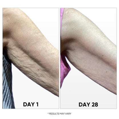 HealthyDerm Crepe Renewal Firming Body Treatment for Crepey Skin