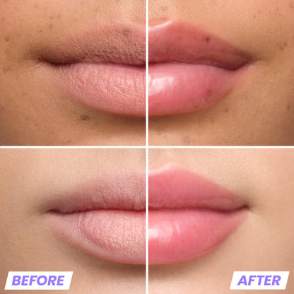 Wonderskin Lip Plumper Gloss - Lip Relapse High Shine & Plumping Gloss