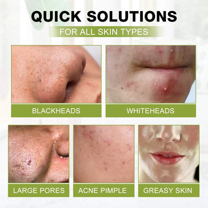 Blackhead Peel Off Face Mask, SHVYOG 3-in-1 Blackhead Remover Mask with Brush & Tea Tree Oil Serum, Charcoal Face Mask for Deep Cleansing Blackheads, Dirts, Pores, Skin Oil (100g+30ml)