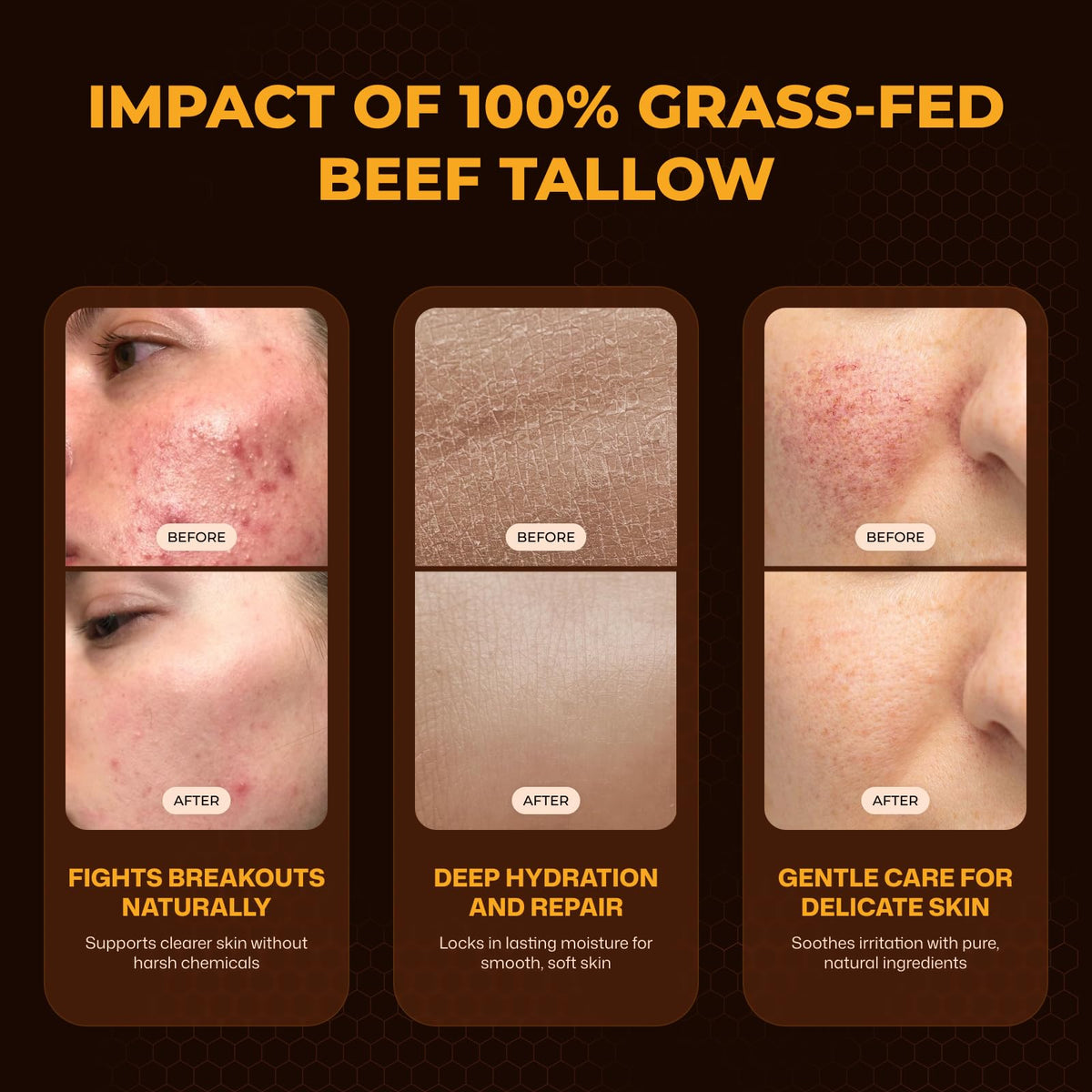 VIORY Tallow and Honey Balm for Face, Beef Tallow for Skin, Moisturizer