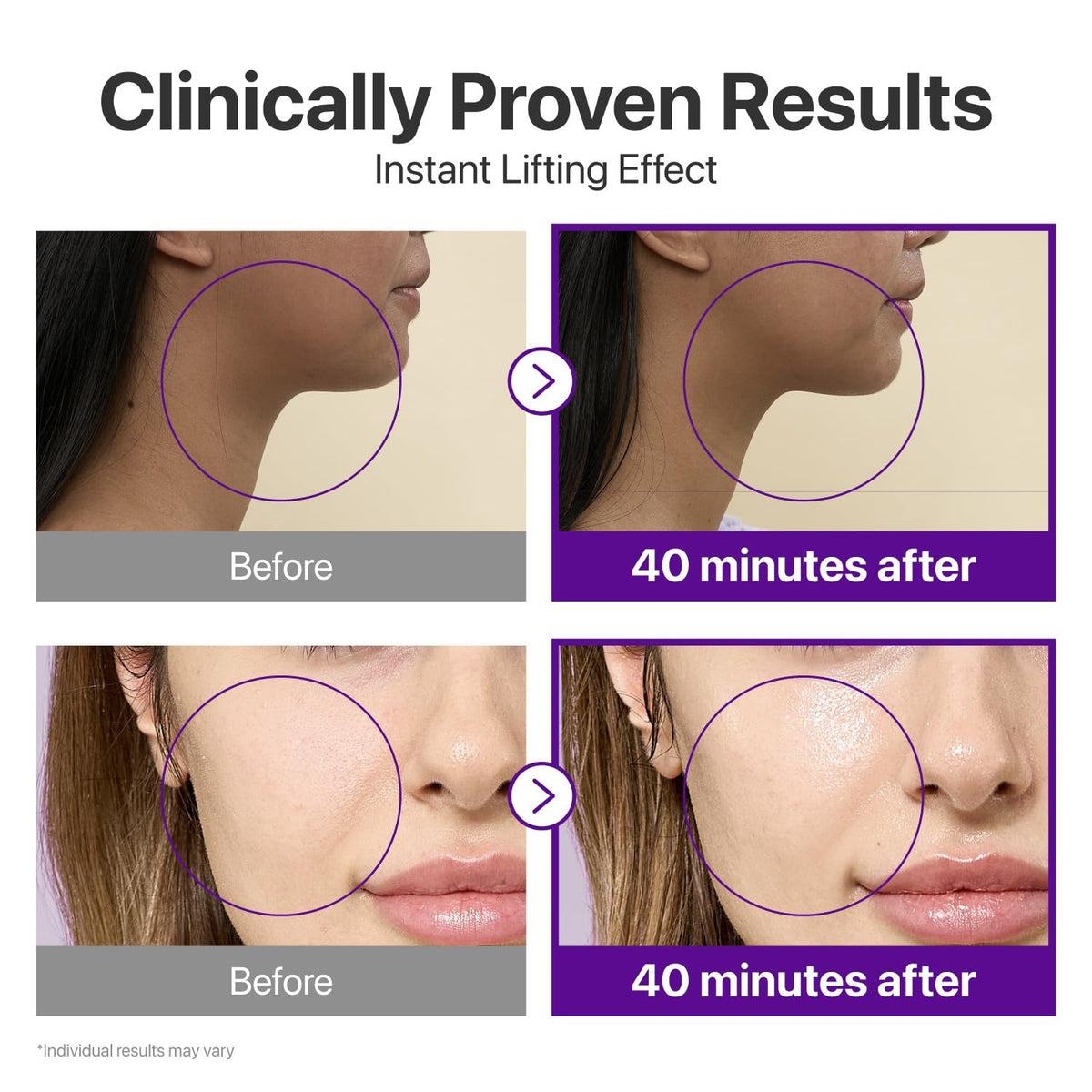 numbuzin No.9 NAD+ BIO Lifting Full Face Mask, 4 Sheets + Lifting Band