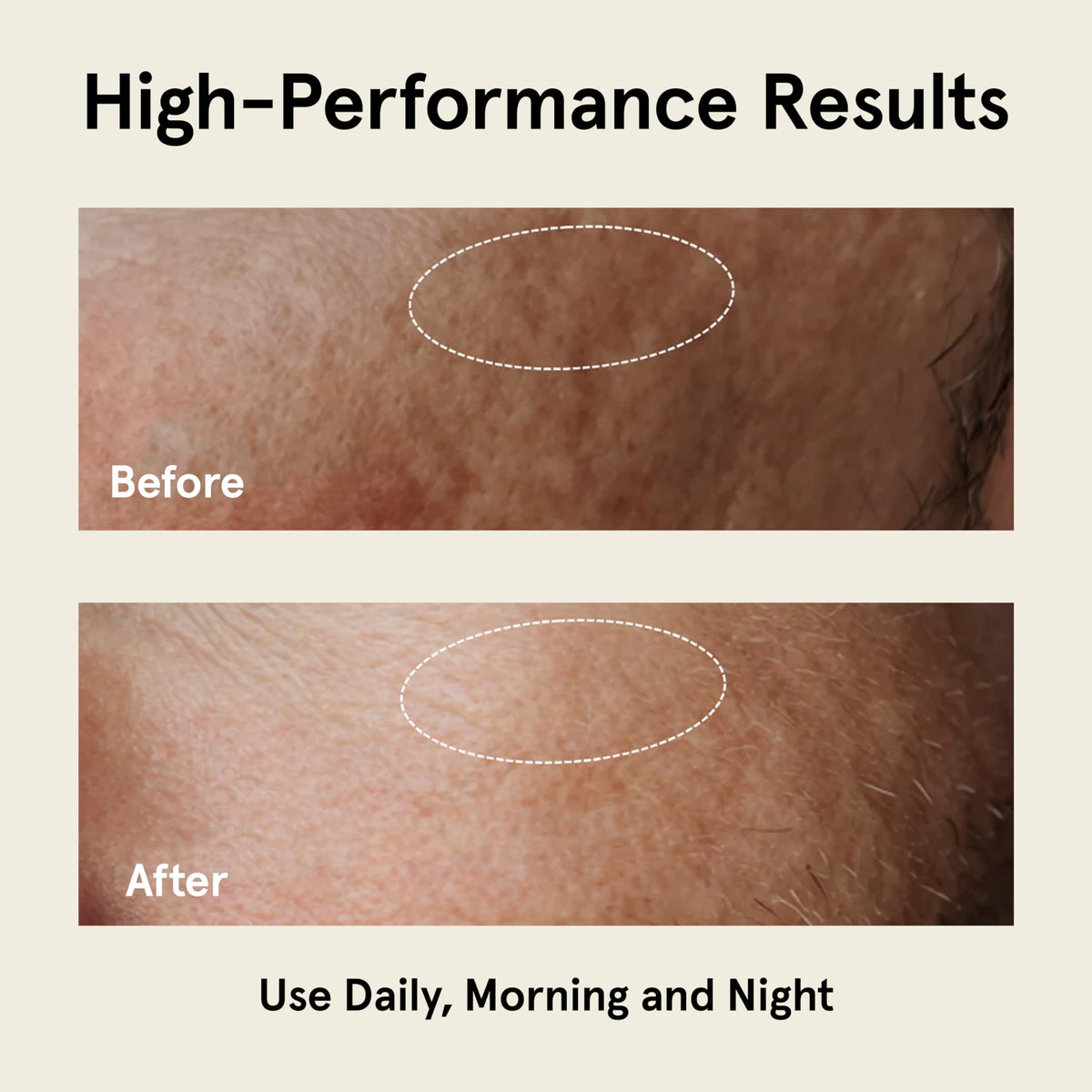 JAXON LANE Relax and Repair Korean Face Moisturizer for Men, 1 Pack