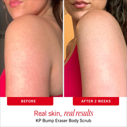 First Aid Beauty Smooth Skin Body Bestsellers Set, 2-Piece