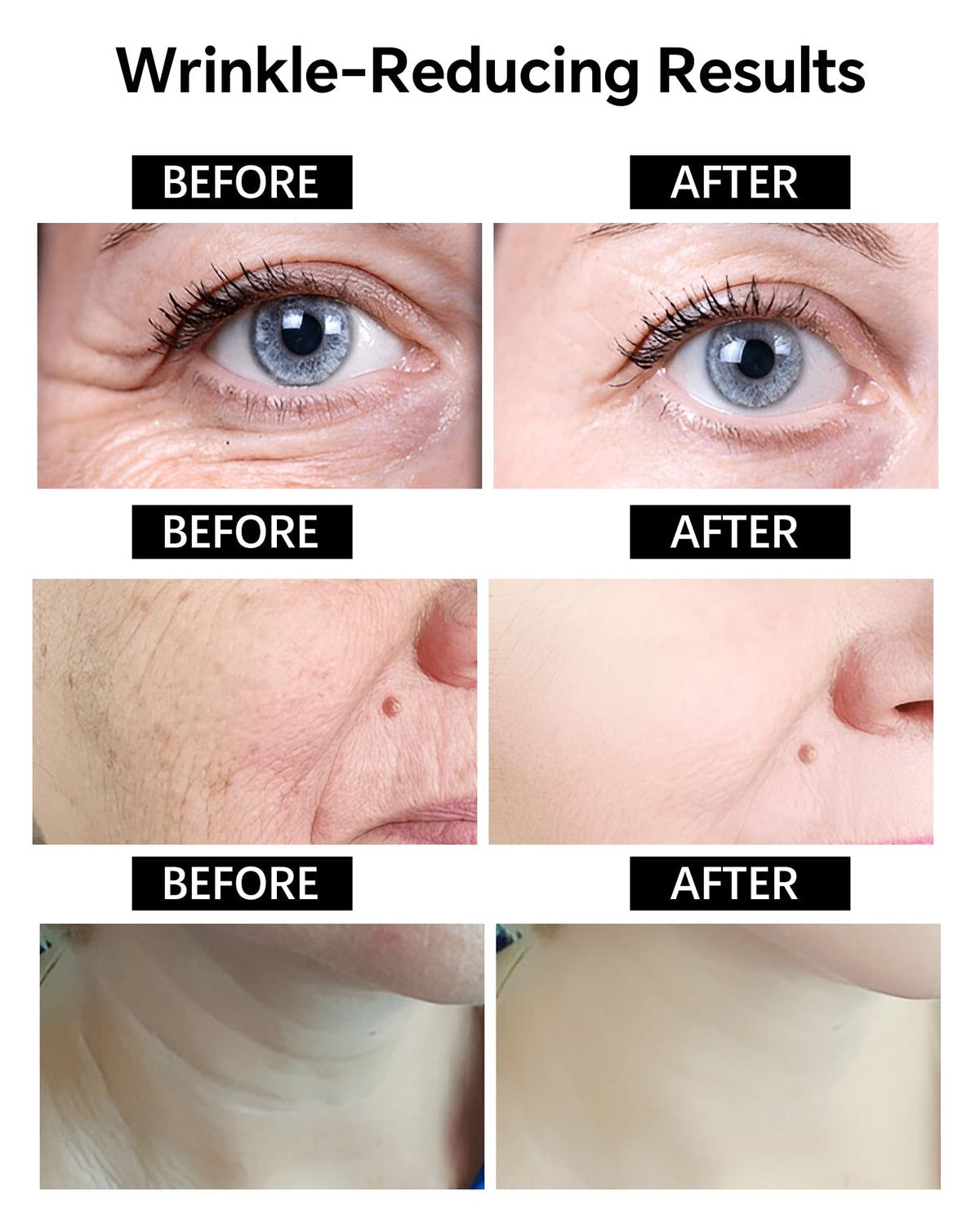 BotoxCream – BotoxBee Venom Skin Treatment Cream