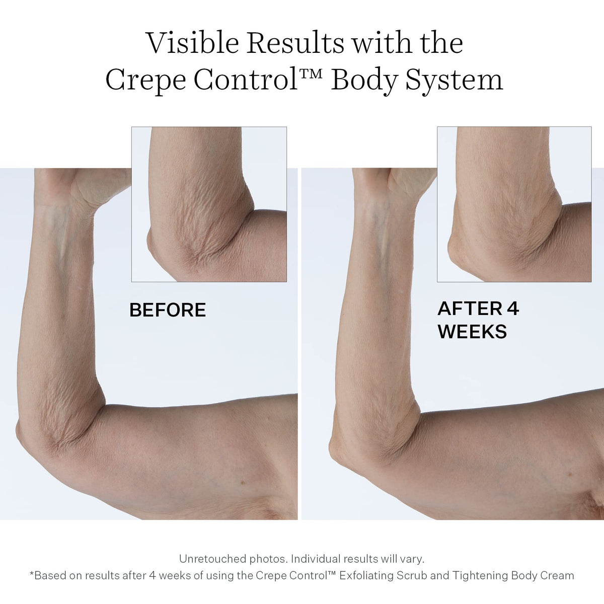 StriVectin Crepe Control® Tightening Body Cream, 6.7 oz