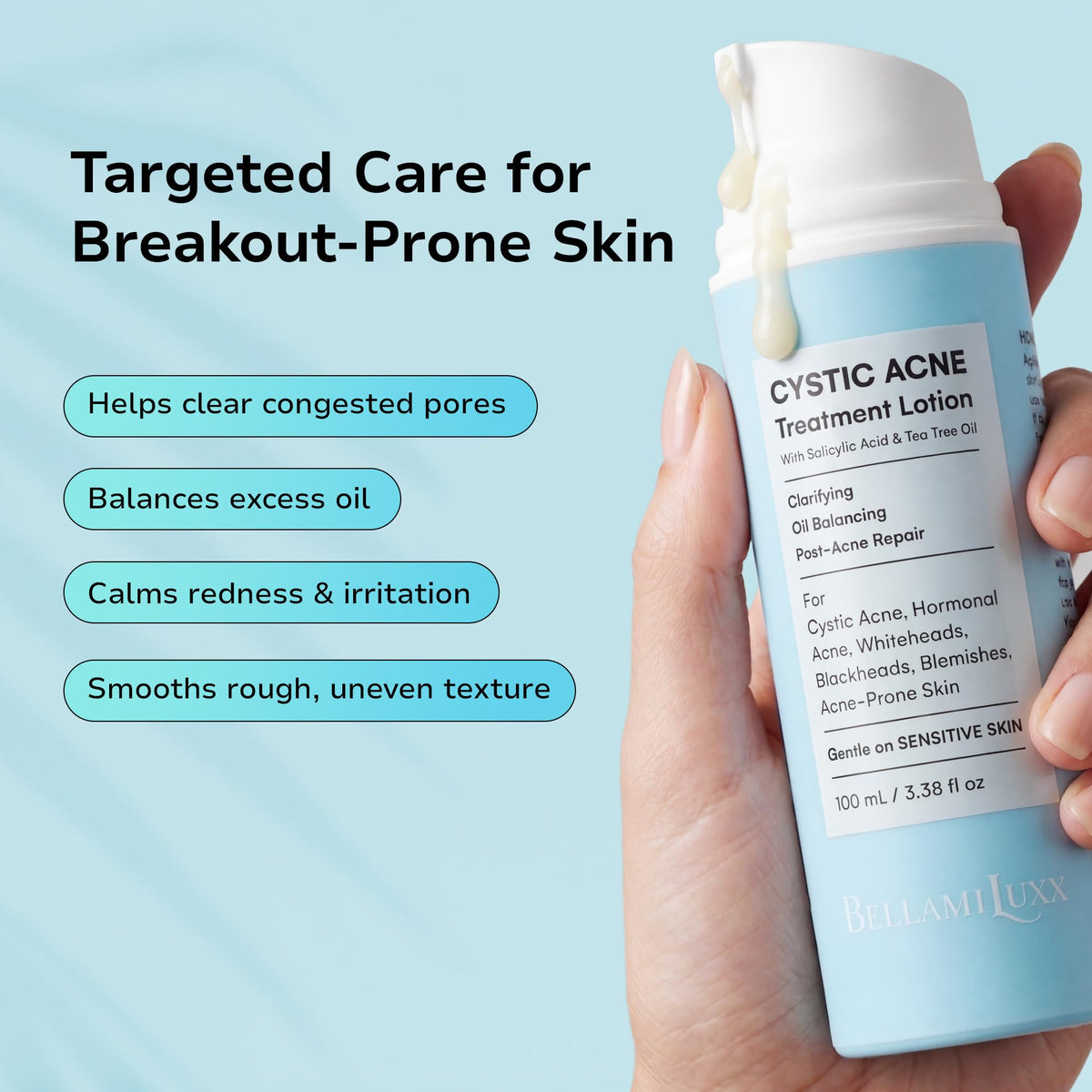 BellamiLuxx Cystic Acne Treatment for Face: Hormonal Acne Treatment Cream for Teens & Adults - Salicylic Acid & Tea Tree Oil Pimple Spot Remover - Anti-Acne Moisturizer Reduces Redness, Blemishes