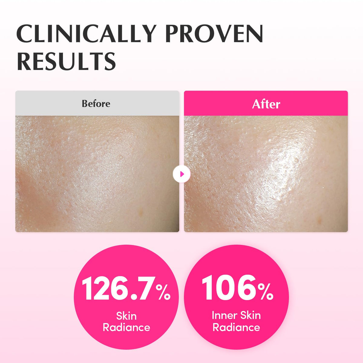 EQQUALBERRY NAD+ Peptide Boosting Toner – NAD+ 5% & 13 Peptides Anti-Aging Korean Skincare Hydrating Face Toner | Firming & Lifting Pink NAD Toner for Sagging Skin (5.07 fl.oz / 150ml)