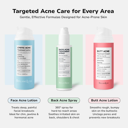 BellamiLuxx Cystic Acne Treatment for Face: Hormonal Acne Treatment Cream for Teens & Adults - Salicylic Acid & Tea Tree Oil Pimple Spot Remover - Anti-Acne Moisturizer Reduces Redness, Blemishes