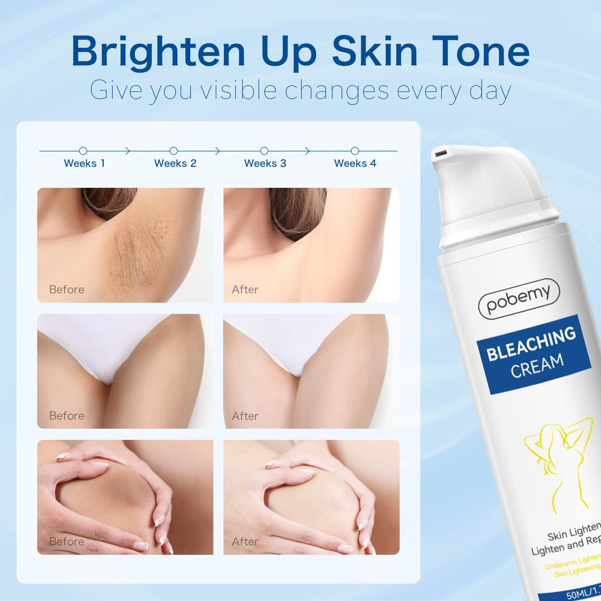 Skin Bleaching Cream, Dark Spot Remover for body& Face, Intimate Areas & Body, Vitamin C Lightening for Underarms, Knees, Elbows, Inner Thighs, Bikini Line – Sensitive Skin Lightening Cream- 1.7FL OZ