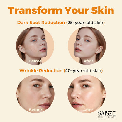 Vitamin C Serum for Face, Facial Serum for Dark Spots and Hyperpigmentation
