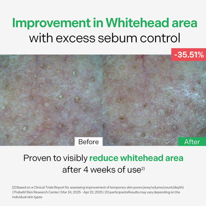 Torriden BALANCEFUL Control Serum 50ml (1.69 fl.oz.) | Daily Sebum & Oil Control for Sensitive Skin | 5D Complex Cica, 4% Niacinamide | Korean Facial Serum