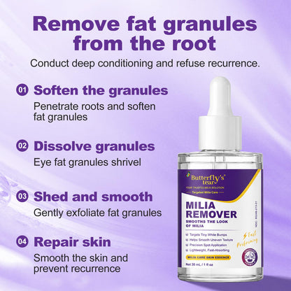 Milia Remover 1% Salicylic Acid for Acne