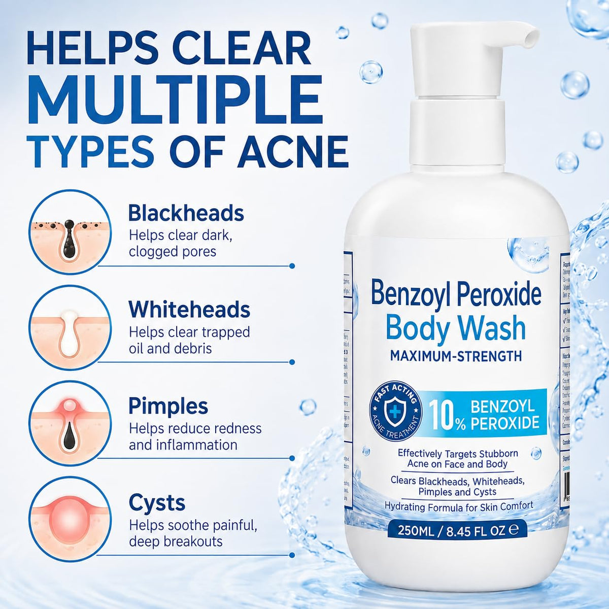 Hermon Benzoyl Peroxide Body Wash: 10% Benzoyl Peroxide Acne Wash for Face, Skin, Butt, and Back Acne - Maximum-Strength Fast-Acting Acne Control Cleanser 8.45 Fl. Oz.