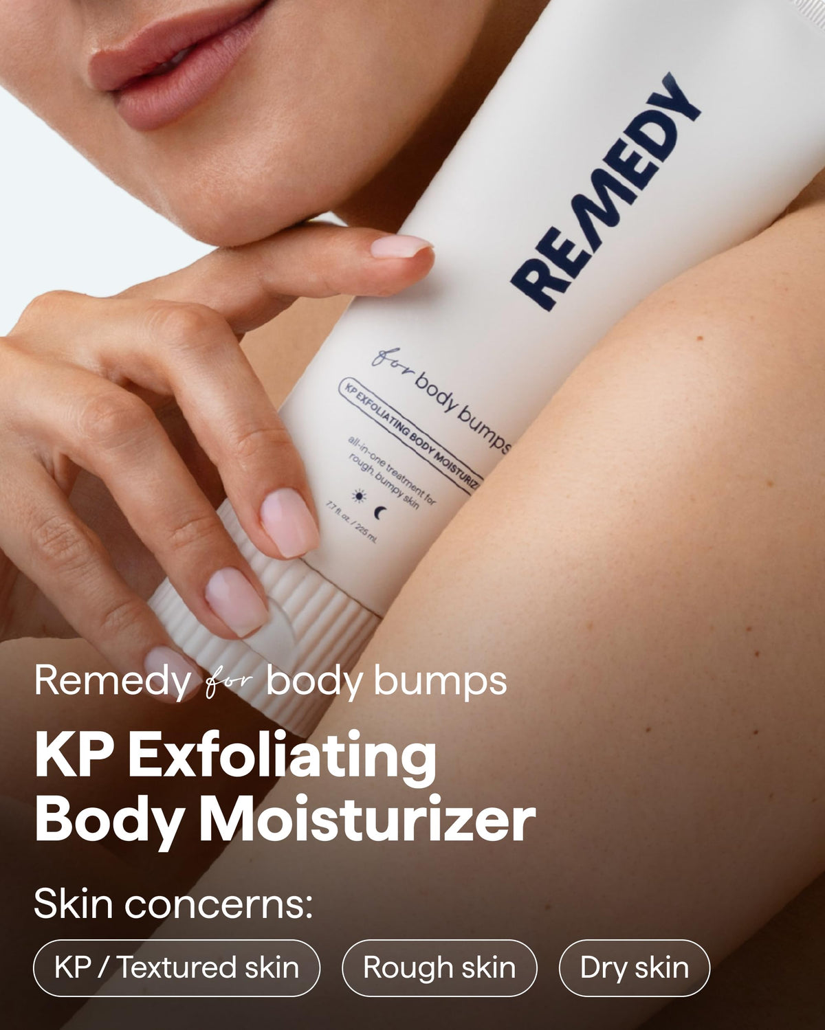 REMEDY KP Body Moisturizer, Exfoliating and Moisturizing Lotion