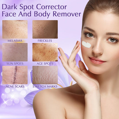 YRNVK Dark Spot Remover for Face and Body, Dark Spot Corrector 1.77 FL OZ