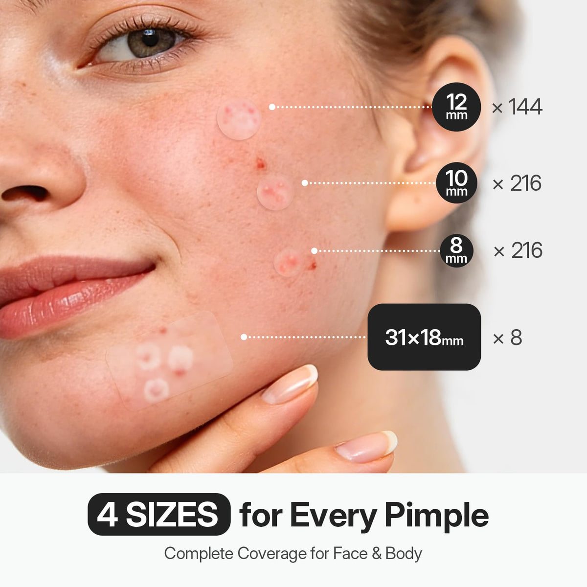 ZATKTK Pimple Patches for Face, 584 Count FSA Hydrocolloid Acne Patches with Salicylic Acid, Bulk Pimple Stickers for Zit Breakouts and Blemishes, 4 Sizes, Fast Absorbing Spot Patch