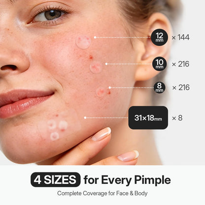 ZATKTK Pimple Patches for Face, 584 Count FSA Hydrocolloid Acne Patches with Salicylic Acid, Bulk Pimple Stickers for Zit Breakouts and Blemishes, 4 Sizes, Fast Absorbing Spot Patch