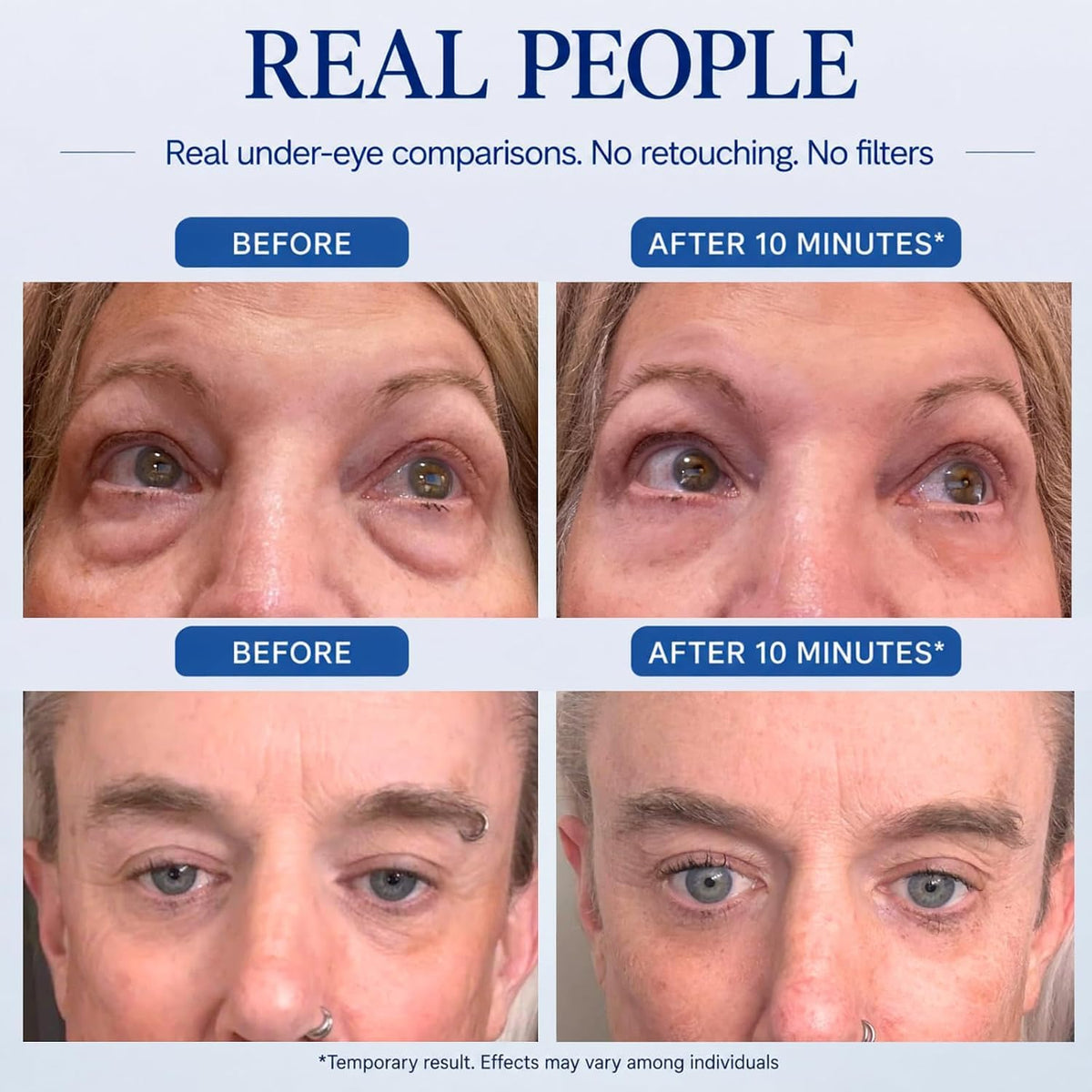 Instant Under Eye Lift Serum - Reduces Eye Bags, Wrinkles, Puffy Eyes, Dark Circles & Crow’s Feet in Minutes - Advanced Firming Polysaccharide Formula for Mature Skin - 20 mL