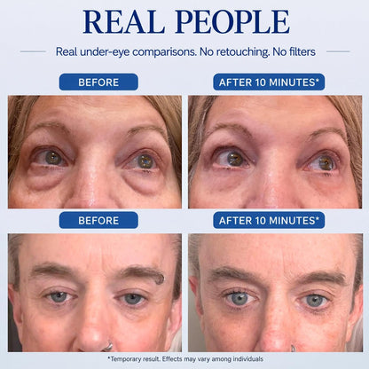 Instant Under Eye Lift Serum - Reduces Eye Bags, Wrinkles, Puffy Eyes, Dark Circles & Crow’s Feet in Minutes - Advanced Firming Polysaccharide Formula for Mature Skin - 20 mL