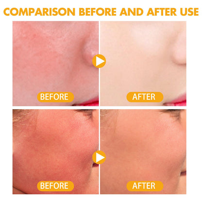 Mineral Powder Sunscreen SPF 50, For Face & Scalp, Oil Control, Lithe