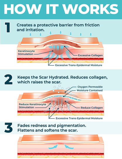 Medical Grade Silicone Scar Tape - 1.6"x70" - Effective Scar Removal