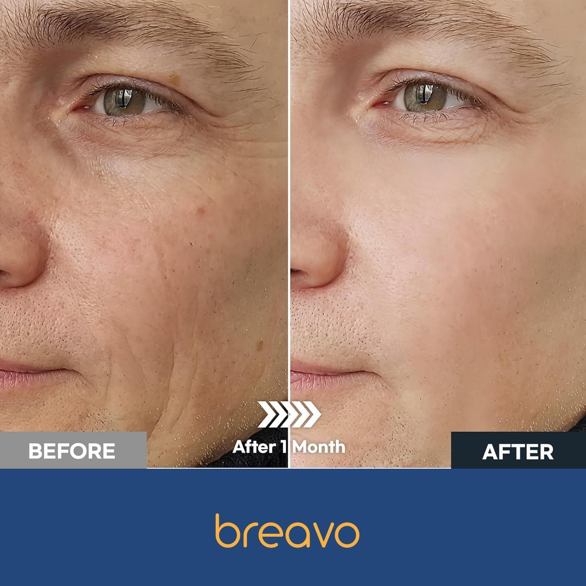 Breavo 6 in 1 Face Cream for Men: 6 in 1 Mens Face Moisturizer, Mens Face Cream Anti Aging - Eye Bags Treatment & Wrinkle Cream for Men 1.7 oz