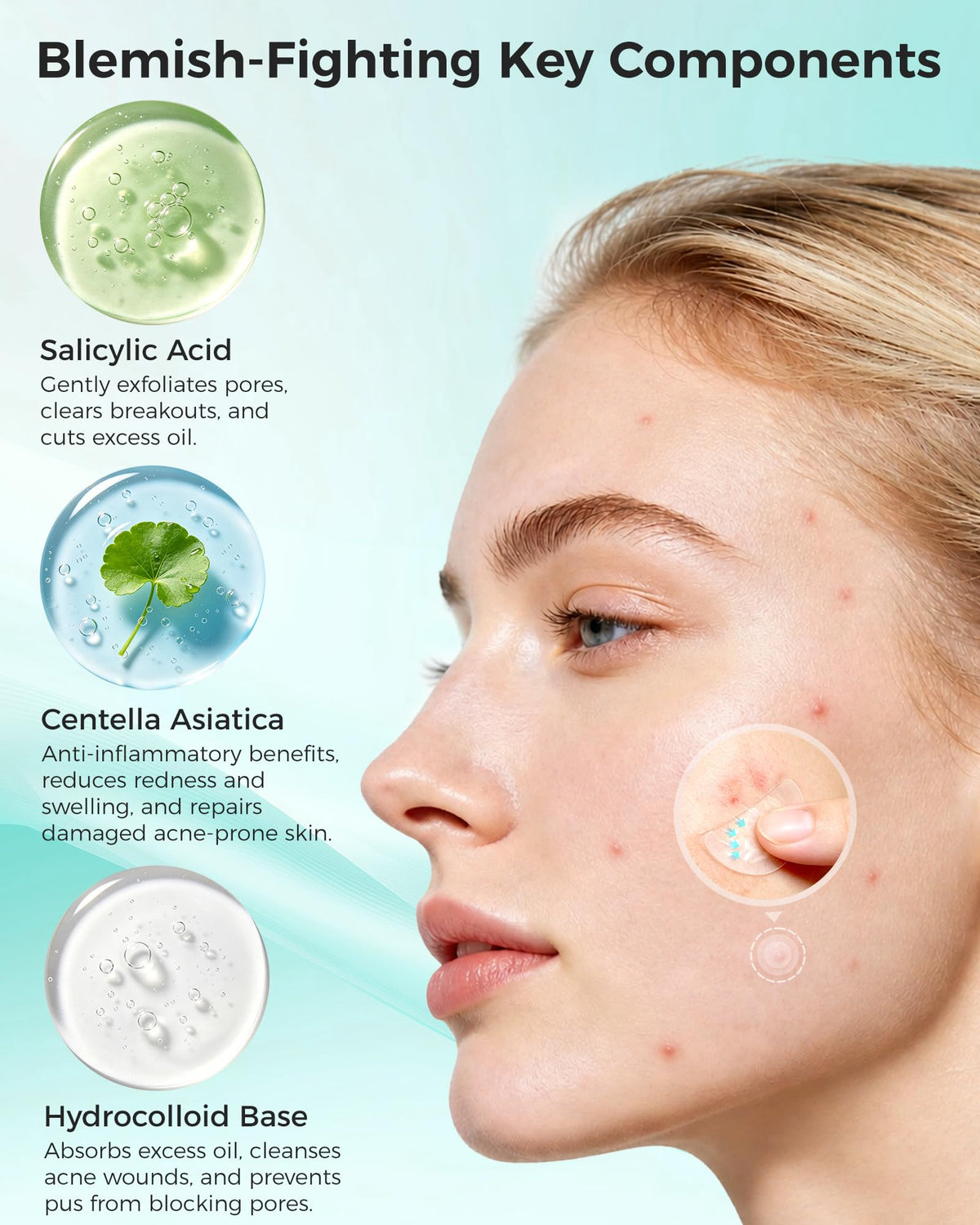 Pimple Patches for Face, 36ct Acne Patches, Microdart & Microneedle Patches