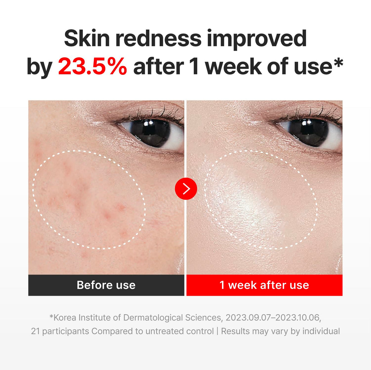 CENTELLIAN 24 Madeca Cream Time Reverse + Active Renew PDRN Cream Duo