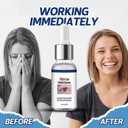 Stye Eye Treatment, Natural Non-Irritating Formula Eyelid Relief 30ml(1PCS)
