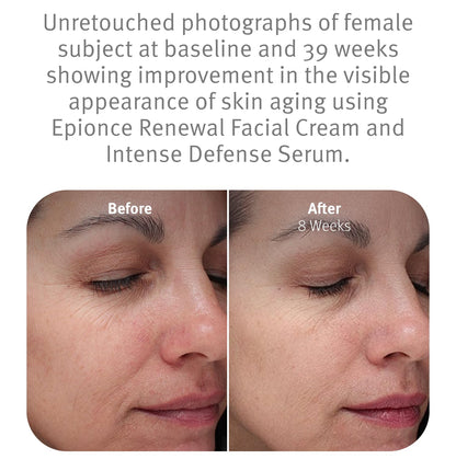 Epionce Renewal Facial Cream Hydrating Anti-Aging Skin Barrier Moisturizer
